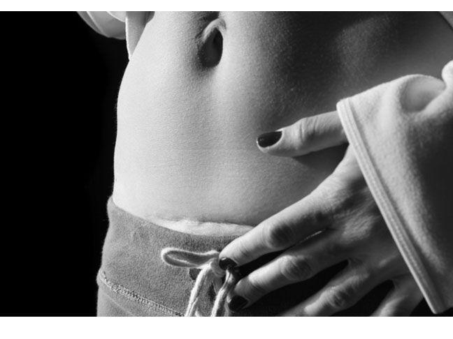 black and white photograph of a woman's stomach with her hands on her hip