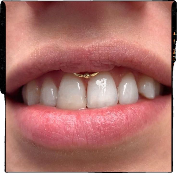 Smiley Piercing - Piercing Idea Smiley Piercing Jewelry Rings, Cute Piercings Face, Smiley Piercing Aesthetic, Smiley Piercing Jewelry, Smiley Piercing Rings, Smile Ring, Smile Piercing, Piercing Face, Mouth Piercings