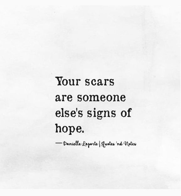 a black and white photo with the quote your scars are someone else's signs of hope