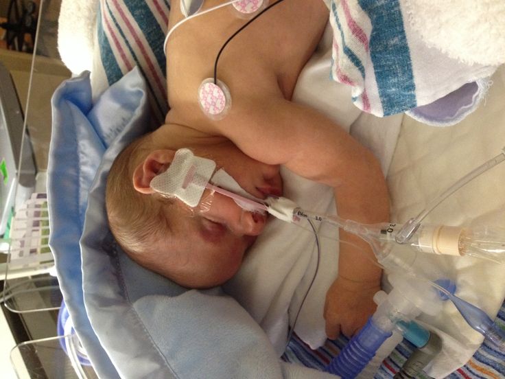 a baby laying in a hospital bed with an oxygen tube attached to it's head