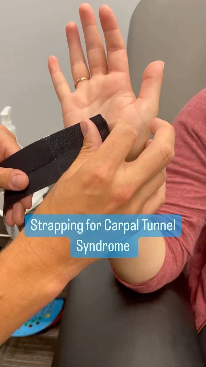 💢Taping for carpal tunnel syndrome💢 . . Here is one of my go to techniques for patients experiencing carpal tunnel syndrome 💪 . . The goal… | Instagram Carpal Tunnel Kt Taping, Carple Tunnel, Carpal Tunnel Relief Exercises, Carpal Tunnel Remedies, Thumb Pain Relief, Diy Braces, Carpal Tunnel Exercises, Carpal Tunnel Relief, K Tape