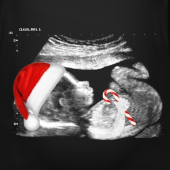 an x - ray image of a santa hat on top of a man's chest