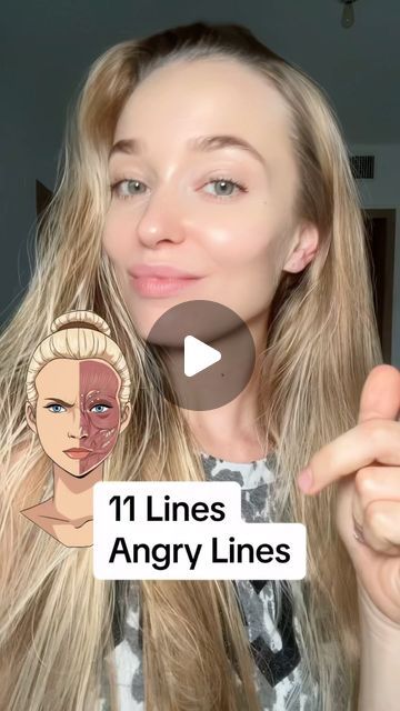 11 Wrinkles, Frown Wrinkles, Face Massage Techniques, Frown Lines, Natural Face Lift, Facial Rejuvenation, Superbowl Party Food, Facial Exercises, Holistic Beauty