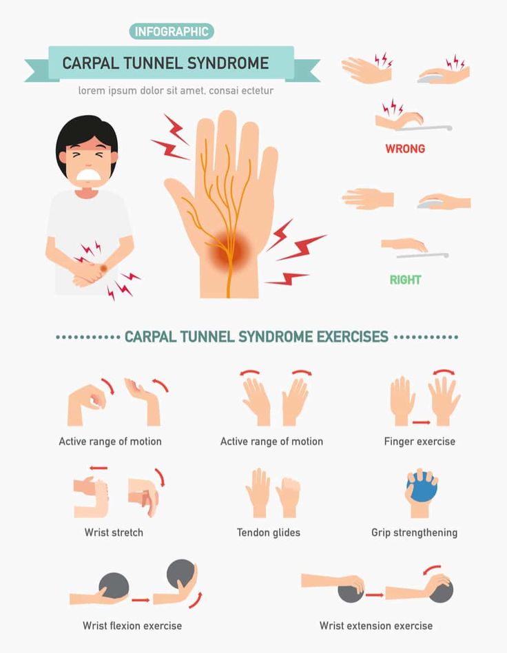 Carpal Tunnel Relief Exercises, Carpal Tunnel Remedies, Hand Therapy Exercises, Carpal Tunnel Exercises, Wrist Pain Relief, Carpal Tunnel Relief, Wrist Exercises, Hand Exercises, Back Pain Remedies