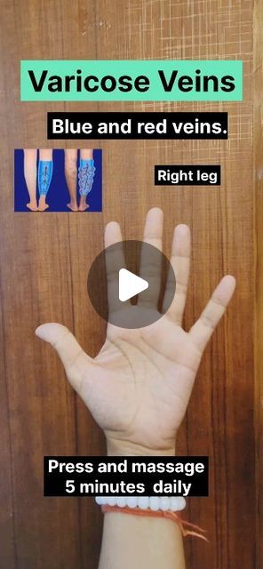 Veins Workout, Varicose Veins Exercises, Improve Leg Circulation, Reflexology Pressure Points, Varicose Vein Cream, Hand Veins, Massage Pressure Points, Vein Health, Pressure Point Therapy