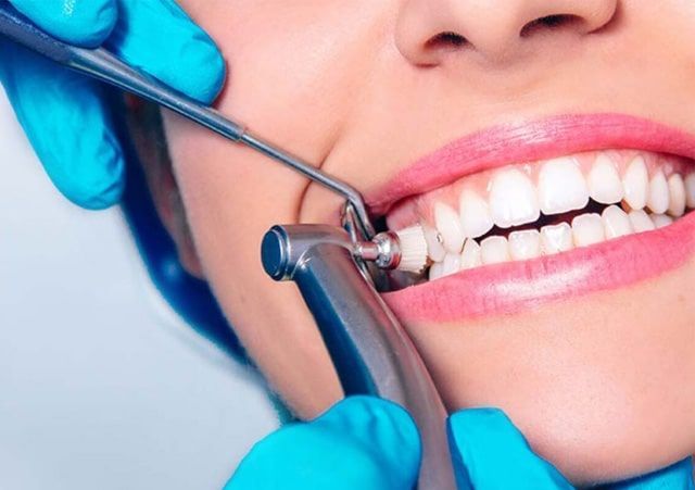 URBN Dental offers teeth cleaning and polishing services in Houston. Find our experienced & qualified Dentists for teeth polishing, scaling, and dental cleaning near me. Dental Mouthguards, Tartar Removal, Teeth Polishing, Remedies For Tooth Ache, Dental Health Care, Teeth Dentist, Tooth Removal, Dental Cleaning, Dental Teeth