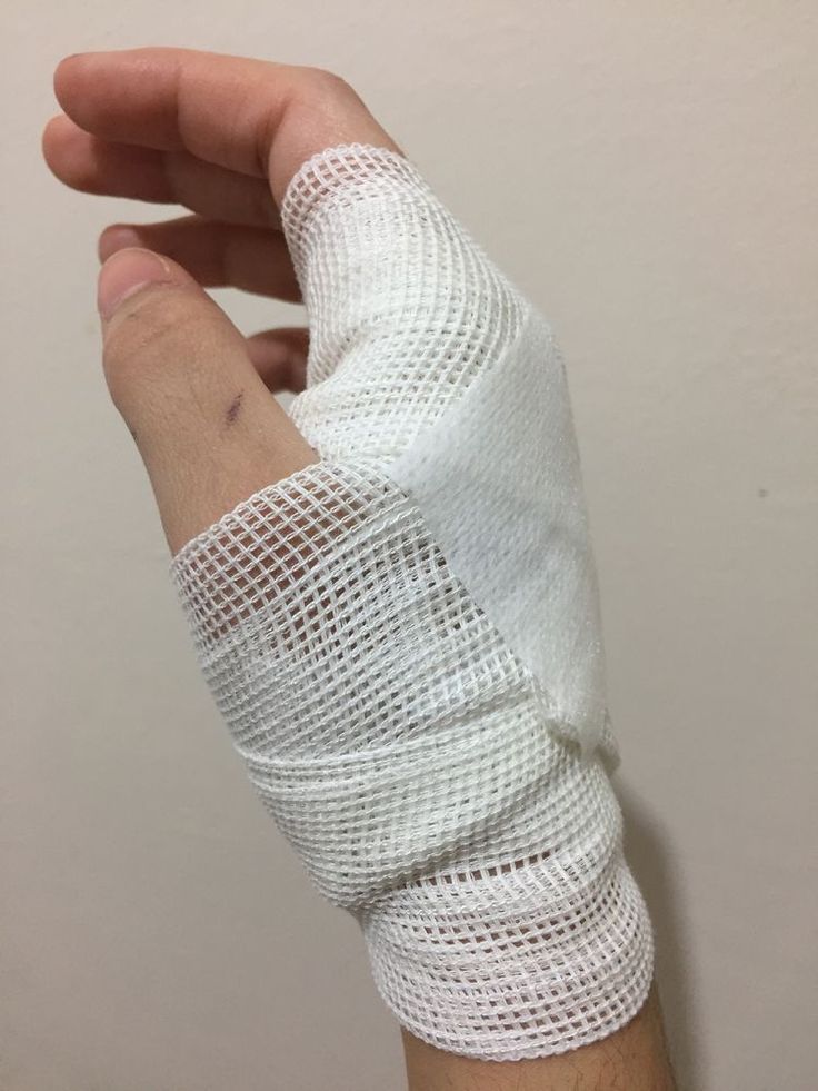 a hand with bandages wrapped around it's wrist and thumb in the other hand