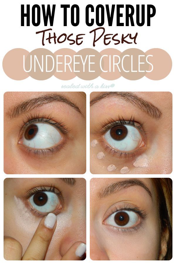 Eye Circles, Undereye Circles, I Love Makeup, Health And Beauty Tips, All Things Beauty, Up Girl, Hair Skin, Makeup Skin Care, Dark Circles