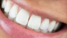 Tooth Decay | Receding Gums