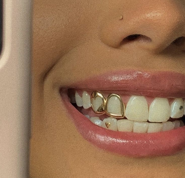 a close up of a person with braces on their teeth and gold rings in front of them