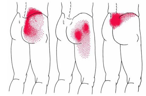 red spots on the back of a person's arm and leg are shown in this diagram