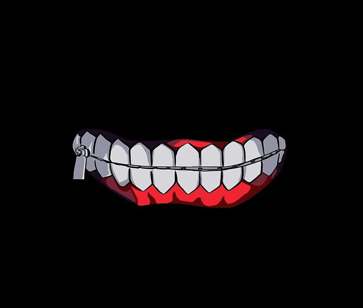 an evil smile with braces on it's teeth, in the middle of black background