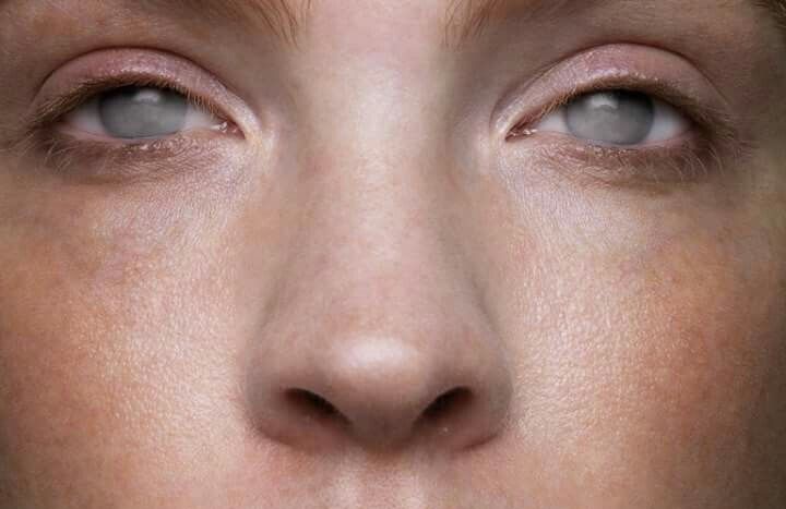 a woman with freckled hair and blue eyes is looking at the camera while she has her face close to the camera