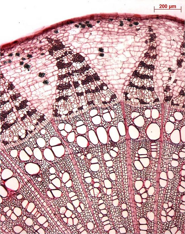 the structure of an animal's skin is shown in red and white colors, with black dots on it