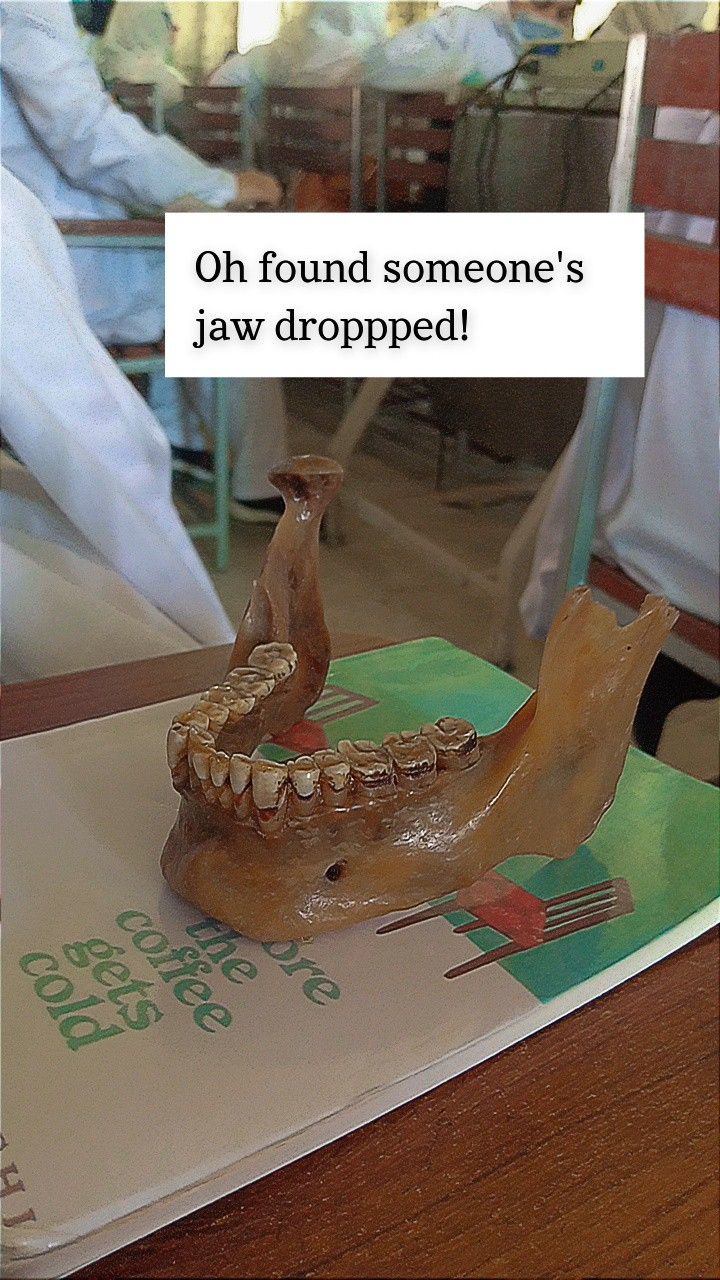 there is a fake tooth and jaw on the table