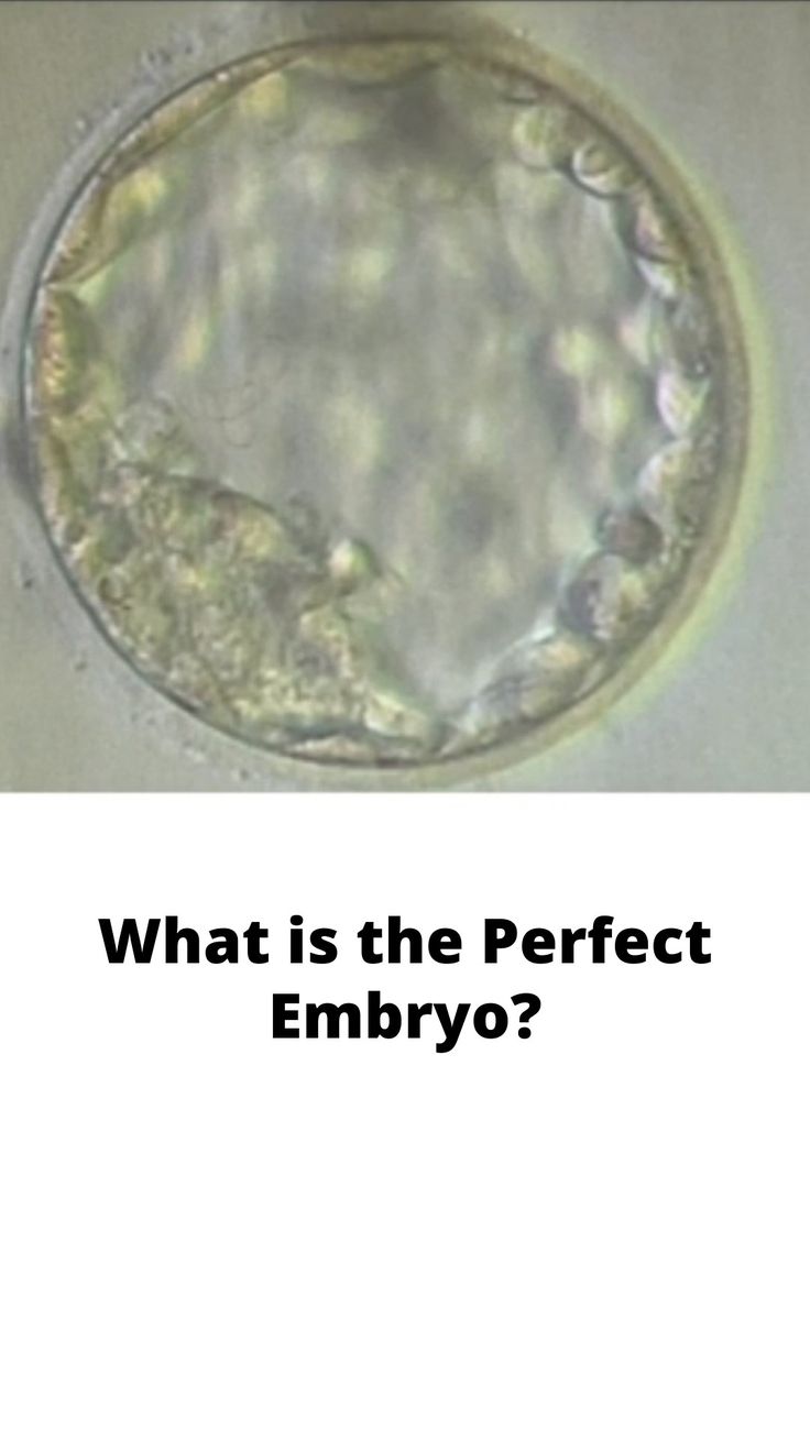 What is the Perfect Embryo? 4aa Embryo, Embryo Loss, Frozen Embryo Transfer Timeline, After Embryo Transfer, Embryo Art, Frozen Embryo Transfer, Thank You Baskets, Fertility Nutrition, Embryonic Development