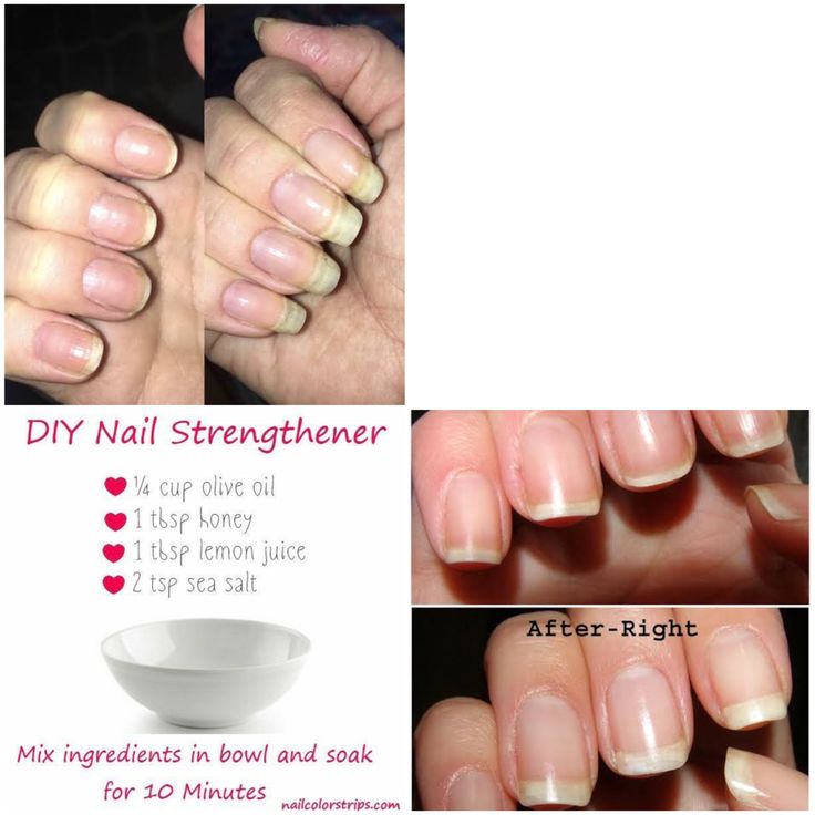 Grow Long Nails, Nail Growth Tips, Recipe Aesthetic, Natural Nail Care, Nagel Tips, Nail Care Tips, Nail Care Routine, How To Grow Nails, Nail Growth