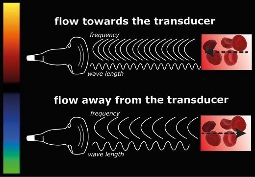 Sonography Humor, Ultrasound Humor, Diagnostic Medical Sonography Student, Ultrasound School, Ultrasound Physics, Cardiac Sonography, Sonography Student, Vascular Ultrasound, Ultrasound Sonography