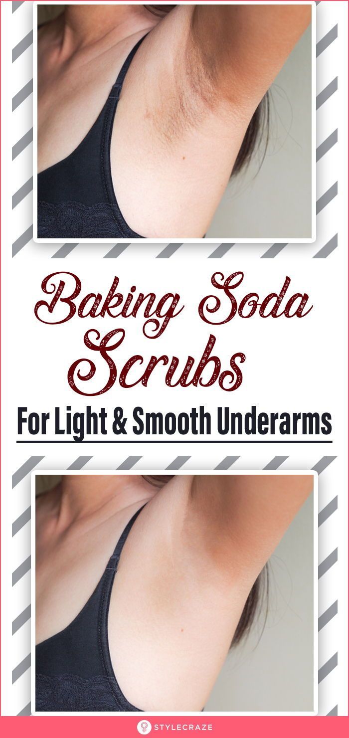 Smelly Underarms, Baking Soda Scrub, Dark Armpits, Remove Unwanted Facial Hair, Unwanted Hair Growth, Armpit Fat, Underarm Hair Removal, Dark Underarms, Unwanted Facial Hair