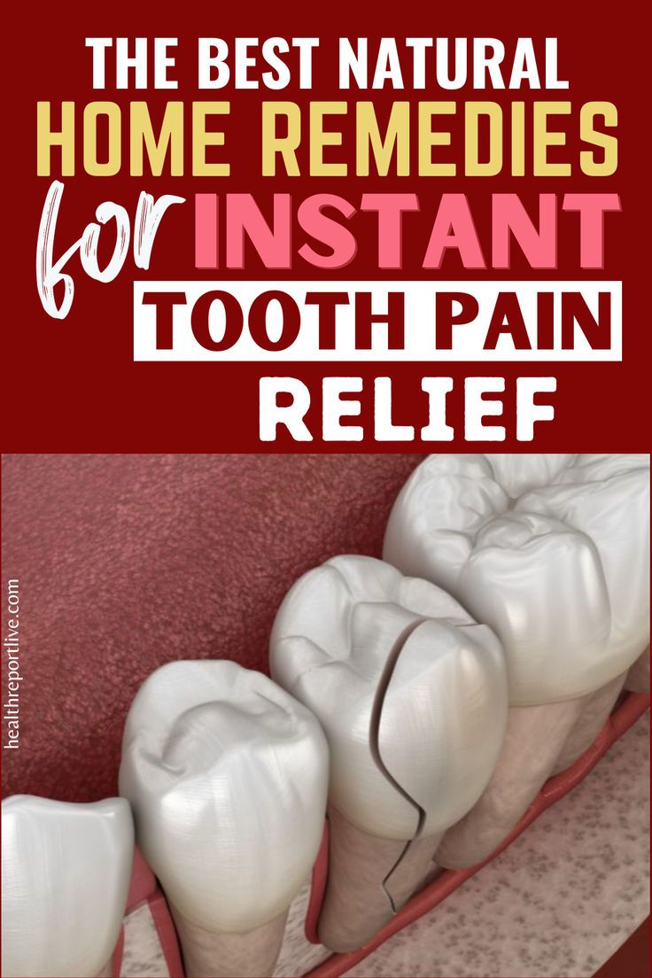 Here is a collage of teeth with a broken tooth Home Remedy For Tooth Ache Pain, Cavity Pain, Cavity Remedy, Wisdom Teeth Pain Relief, Tooth Pain Remedies, Wisdom Teeth Pain, Tooth Pain Relief, Tooth Ache Relief, Tooth Decay Remedies