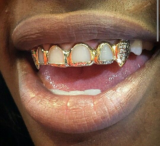 Gold Teeth Grills, Fang Grillz, Teeth Gems, Dental Jewelry, Grillz Teeth, Diamond Grillz, Gold Grill, Diamond Teeth, Dope Jewelry Accessories