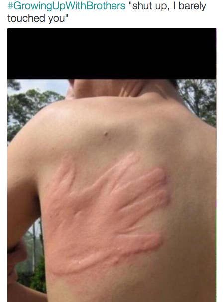 the back of a man's body with pink pigment on it and his arm