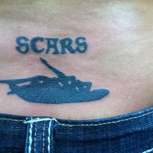 a woman's stomach with the word scarrs written on it