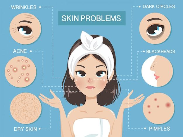 Skin Infographic, Vitamin E Uses, Vitamin C Face Mask, Problem Skin, Beauty Vitamins, Beauty Illustration, Beauty Skin Care Routine, Face Skin Care, Skin Problems