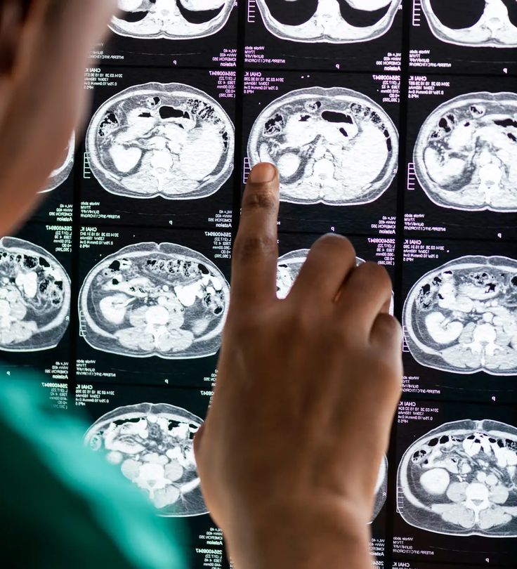 a person pointing at mri images on a wall