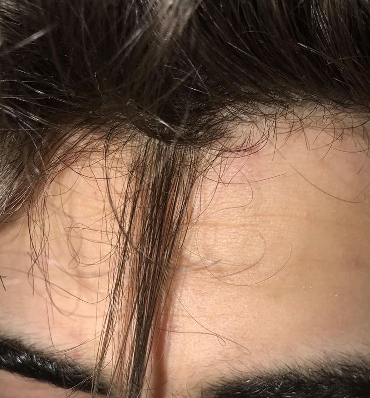 the top part of a man's head with hair on it