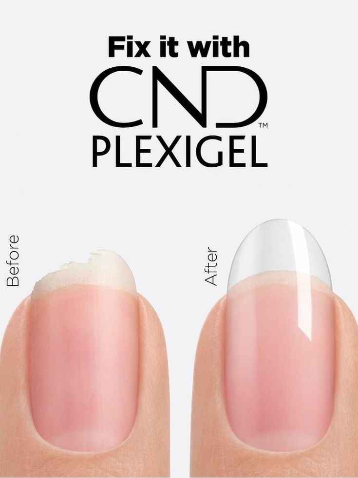 CND Plexigel Brush-In-A-Bottle Gel Nail Extension System The CND Plexigel System Is Versatile And Convenient Nail Enhancement System in a bottle.Provides Up To 3+ Weeks Of Strength, Length, And Shape. Fill It with Shaper or Builder: Save Cracked Nails With Wearable Patches. Fix It with Builder: Repair Broken Nails. Shape It with Shaper: Plump And Shape Flat Nails. Build It with Builder: Create Customizable Length. Basecoat with Bonder Topcoat with Protector Top Coat Repair Broken Nail, Cracked Nails, Remove Gel Polish, Weak Nails, Gel Nail Extensions, Broken Nails, Gel Nail Tips, Almond Nail, Nail Forms