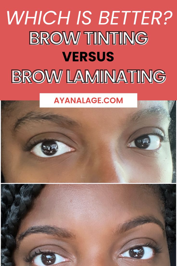 The best tips and everything you need to know about brow tinting! I am sharing my brow tinting before and after and explaining why I prefer it to brow laminating! Eyebrow Lamination Before And After, Brow Lamination Before And After, Eyebrow Before And After, Henna Eyebrows, Eyebrows Microblading, Lash And Brow Tint, Lash Tint, Henna Brows, Dark Underarms