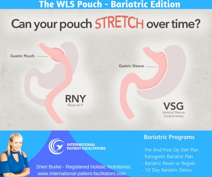 The WLS Pouch - Bariatric Edition - International Patient Facilitators How To Get Back On Track After Vsg, Roux N Y Surgery, Roux En Y Surgery, Bariatric Bits, Bariatric Tips, Pouch Reset, Gastric Surgery, Stomach Sleeve, Vsg Surgery