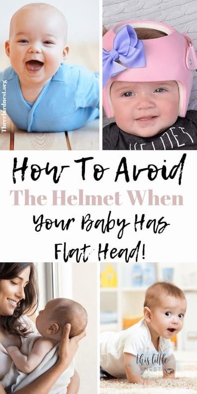 a collage of photos with the words how to avoid the helmet when your baby has flat head