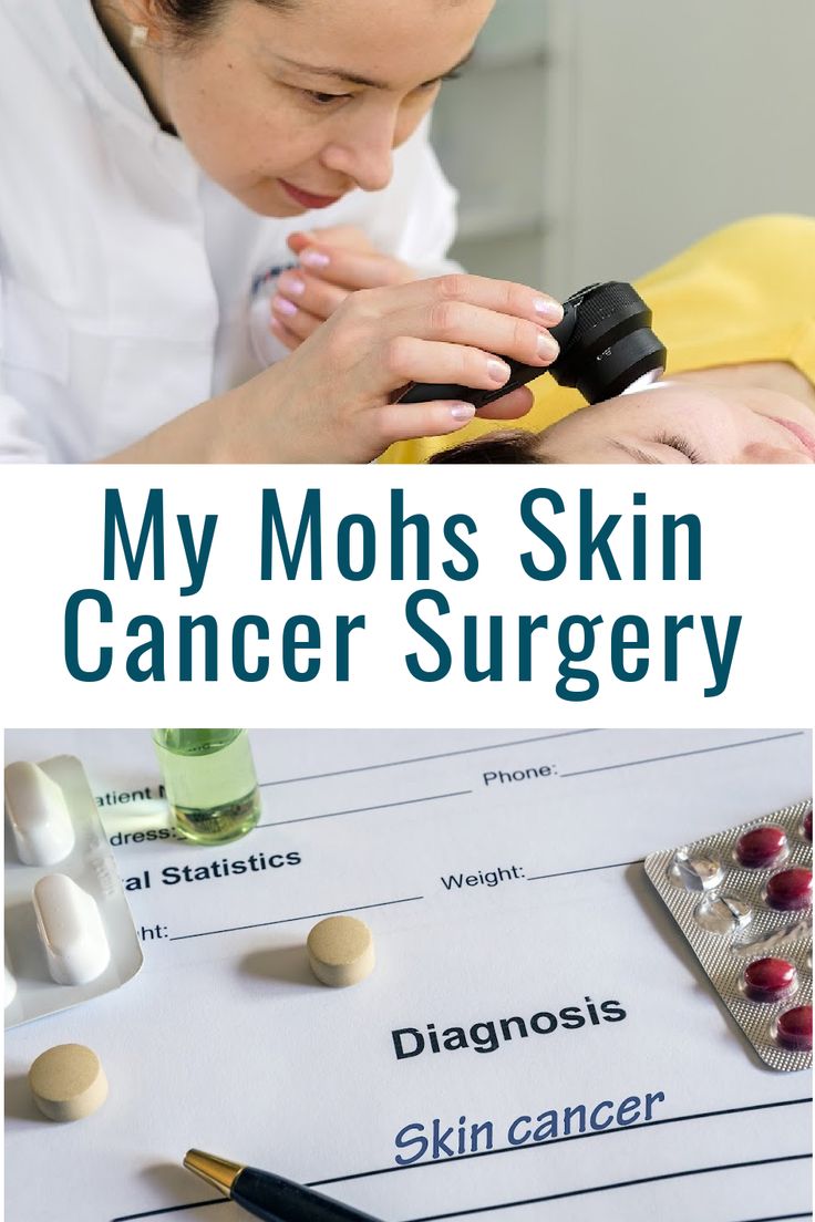 Mohs Skin Surgery, Basal Cell, Skin Grafting, Squamous Cell, Fitness Blog, Dermatology, Esthetician, Second Skin, Surgery