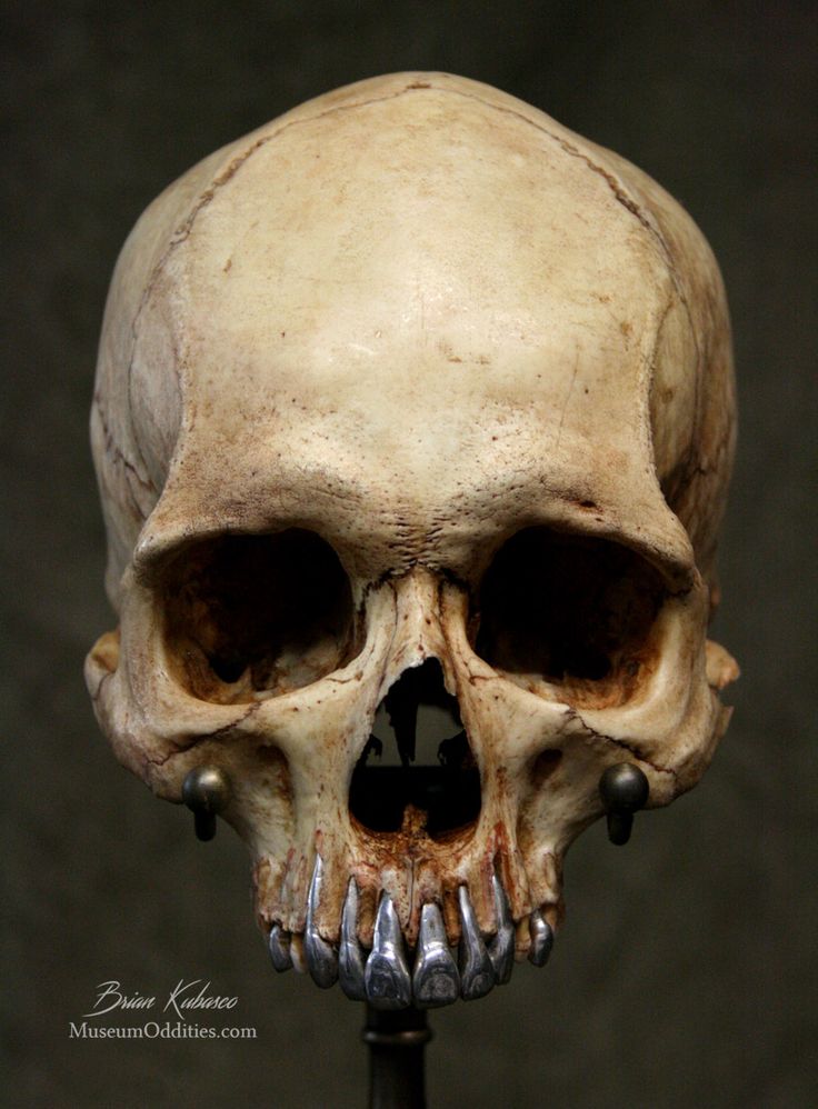 a human skull is displayed on a black stand with the lower part missing from it's head