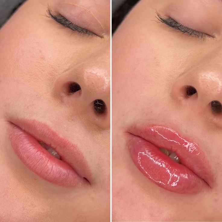 two pictures of a woman's lips and nose