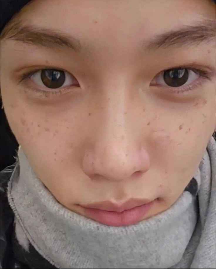 felix insta stories update 231217 Beautiful Freckles, Prince Felix, Bare Face, Felix Skz, Felix Lee, Skz In Cute, Felix Stray Kids, Pretty Eyes, Lee Felix