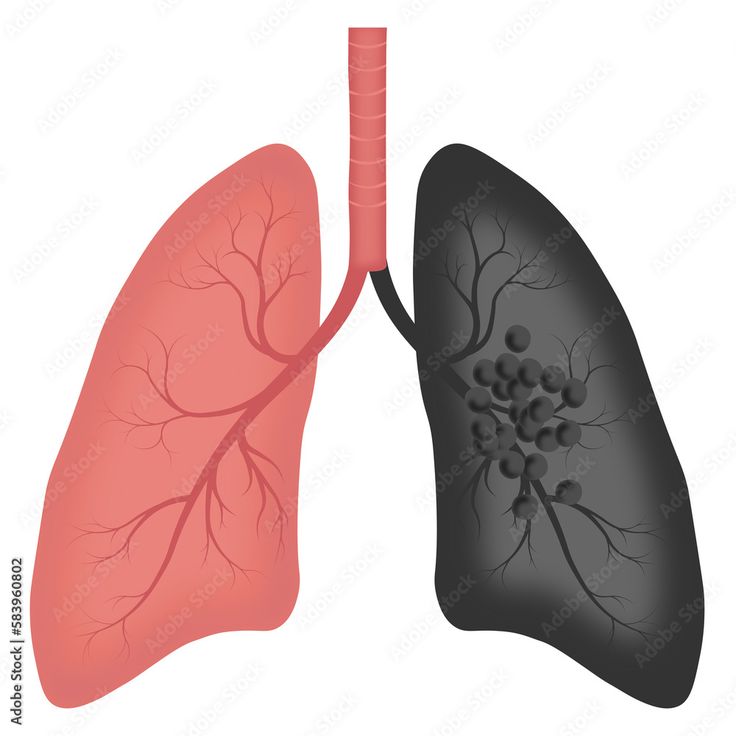 the lungs are shown in this diagram