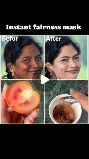 Diy Mask For Tan Removal, Fairness Face Pack Homemade, Best Cream For Glowing Skin, Instant Glow Up Tips, Facepack For Glowing Skin, Masoor Dal Face Pack, Face Pimples Remedies, Face Pack For Glowing Skin, Face Mask Skincare