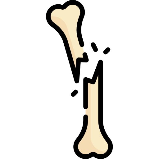 a bone that has been broken in half and is falling off the side of it