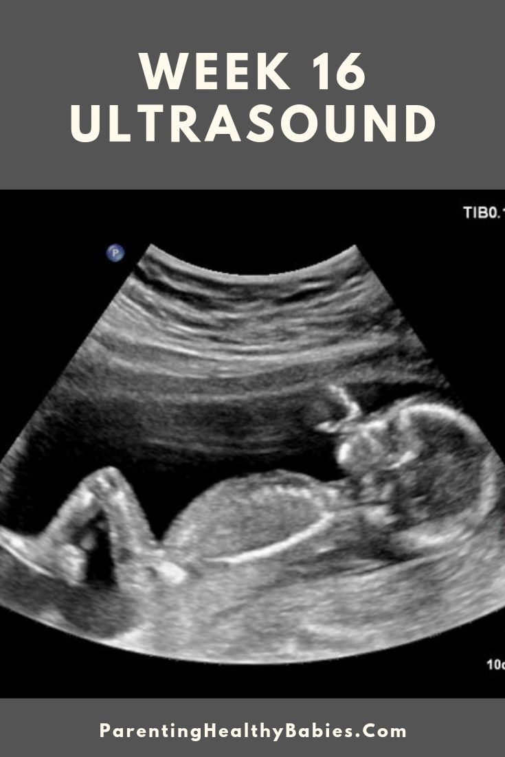 an x - ray image with the words, week 16 ultrasound