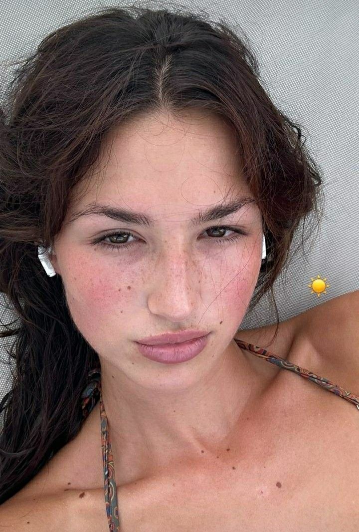 Bare Skin Aesthetic, Sunburn Aesthetic Face, Simple Sunkissed Makeup, Freckles All Over Face, Sunburnt Face Aesthetic, Clear Skin With Freckles Aethstetic, Sunkissed Skin Aesthetic, Bare Face Girl, Cute Freckles Aesthetic