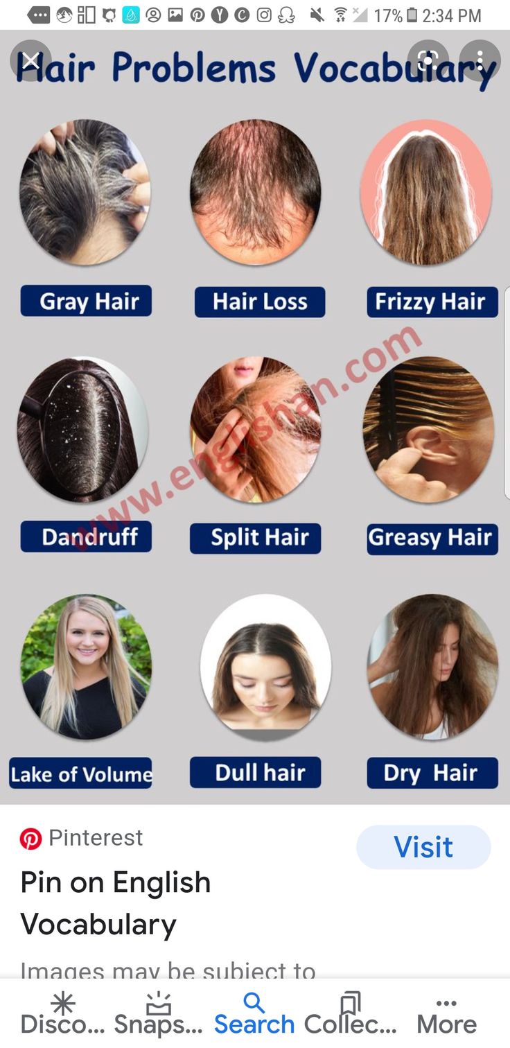 an image of hair problems on the webpage, which shows different types of hair