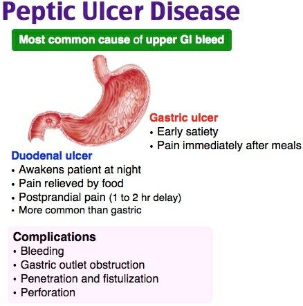 Peptic Ulcer Disease Medic School, Gastrointestinal Nursing, Gi System, Nurse Practitioner School, Medical Mnemonics, Nursing School Essential, Gastrointestinal System, Nurse Study Notes, Nursing Mnemonics