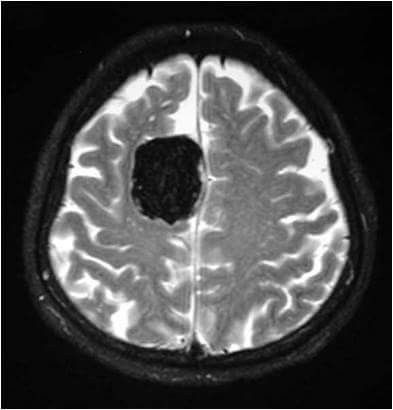 Brain Xray, Brain Mri, Science Aesthetic, Mri Brain, Radiology Imaging, Mri Scan, Human Anatomy And Physiology, Ct Scan, Science Biology