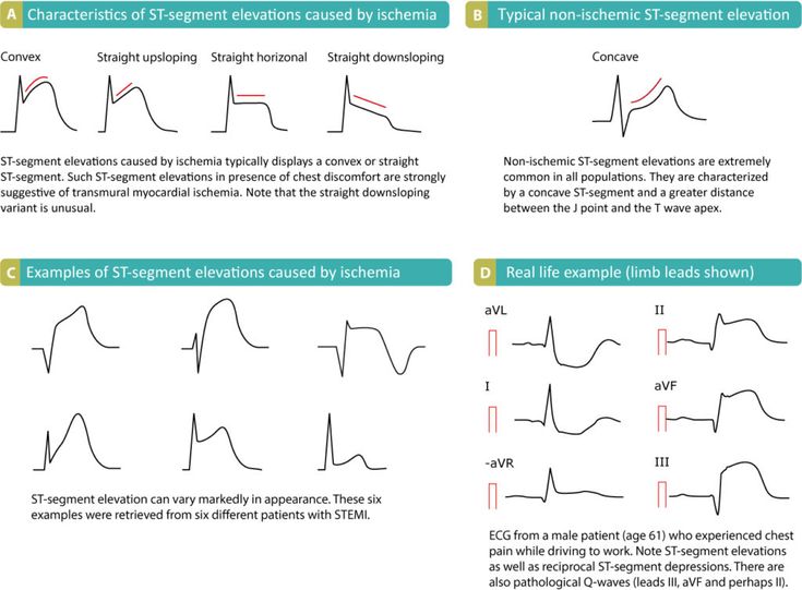 four different types of waveforms are shown in the diagram, and each one is labeled with