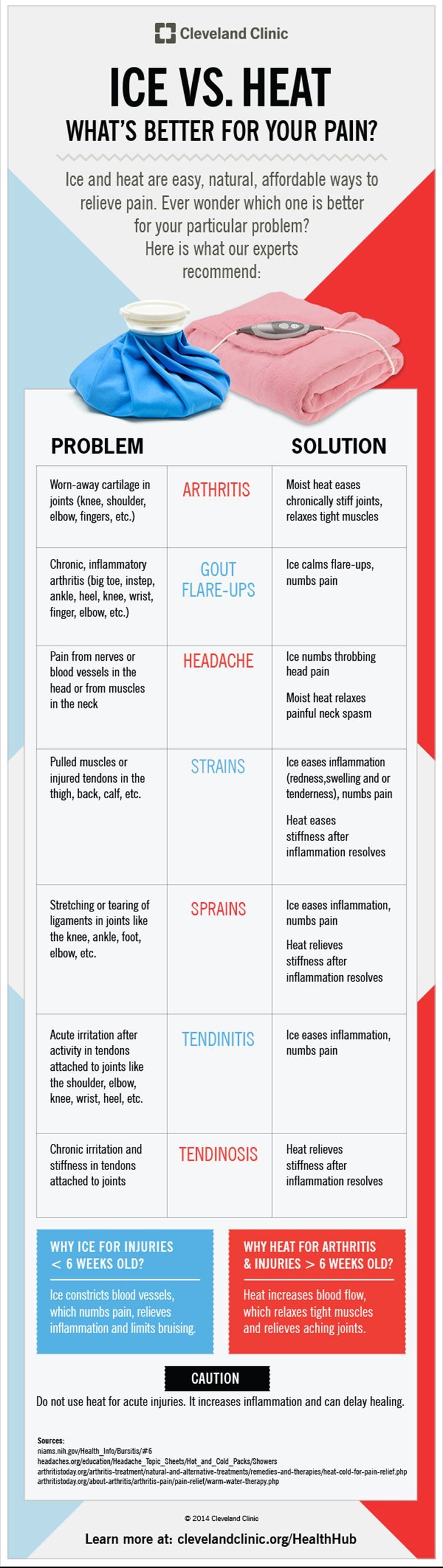 Ice vs. Heat: What's Best for Your Pain? Ice Vs Heat, Trening Fitness, Cleveland Clinic, Yoga Exercises, Health Articles, Sciatica, Health Info, Massage Therapy, Health Remedies