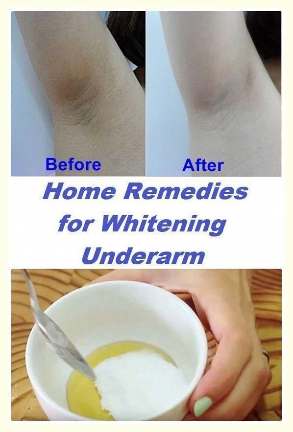 Whiten Underarms Fast, Whiten Underarms, How To Whiten Underarms, Dark Armpits, Underarm Hair Removal, Dark Underarms, Natural Cleanser, Unwanted Hair, Herbal Remedies