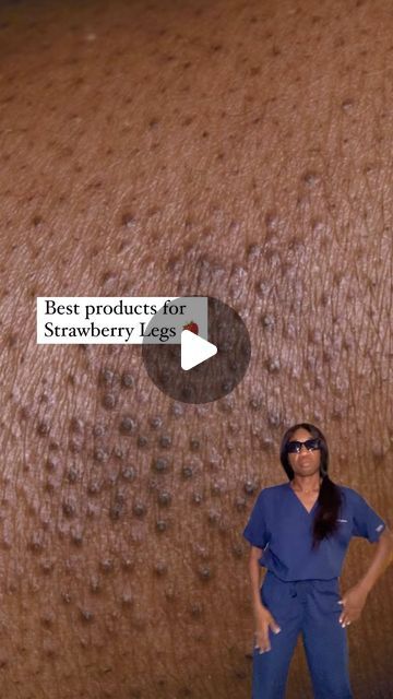 Strawberry Skin How To Get Rid, How To Get Rid Of Strawberry Legs Fast, Strawberry Skin, Strawberry Legs, Smooth Legs, Consistency Is Key, Alpha Hydroxy Acid, Beauty Regimen, Improve Skin Texture